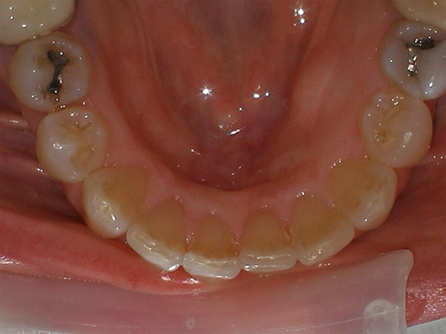 invisible orthodontics